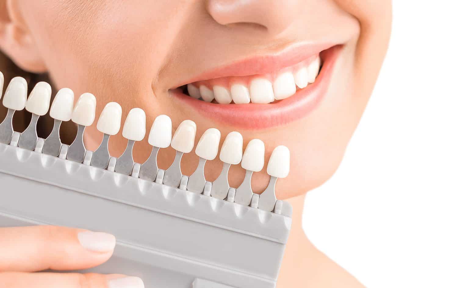 Vollkeramikkronen in Köln